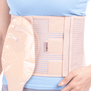 Stomatex Duo Stoma Support